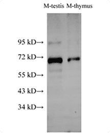 AMPK alpha2 Polyclonal Antibody