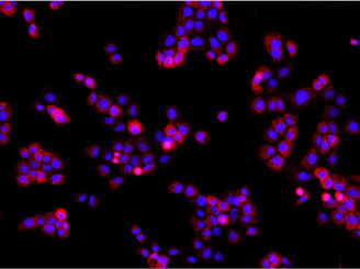 EGFR-- Epidermal growth factor receptor