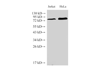 IL-6R-- Interleukin-6 receptor