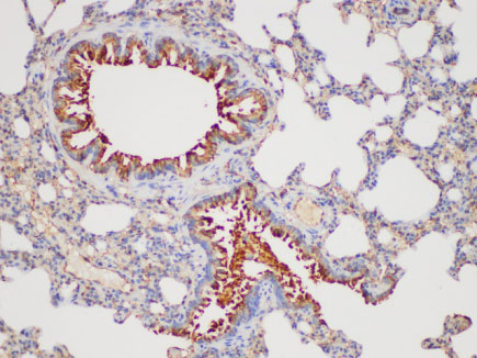 GSTp1 Polyclonal Antibody