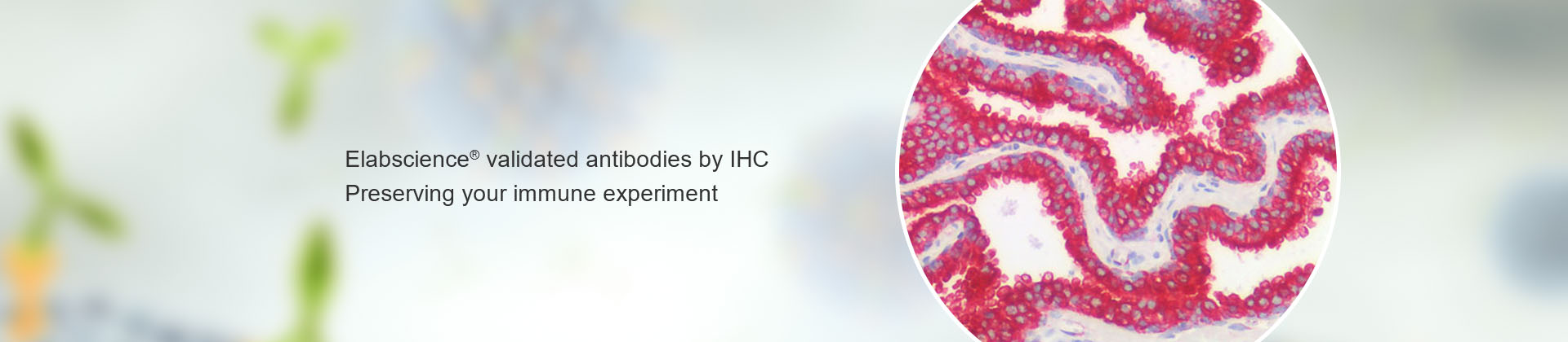 IHC validated antibody