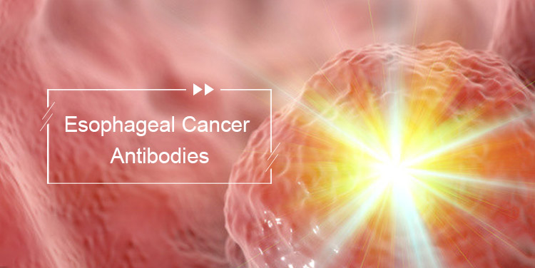 Esophageal Cancer Antibodies